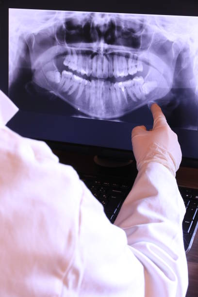 Best Emergency Tooth Extraction in Valley Green, PA